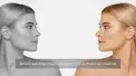 Understanding Plastic Surgery