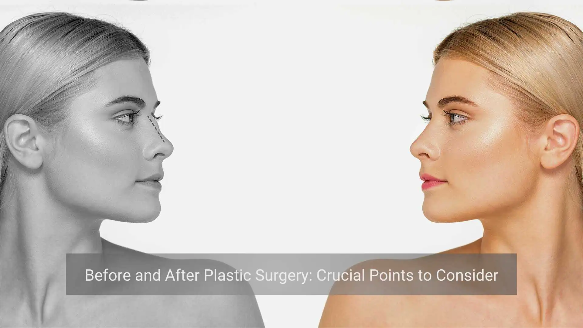 Understanding Plastic Surgery