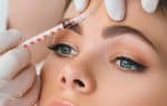 botox anti-aging santa barbara