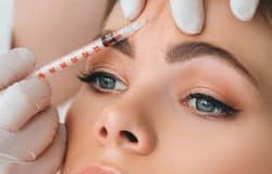 botox anti-aging santa barbara