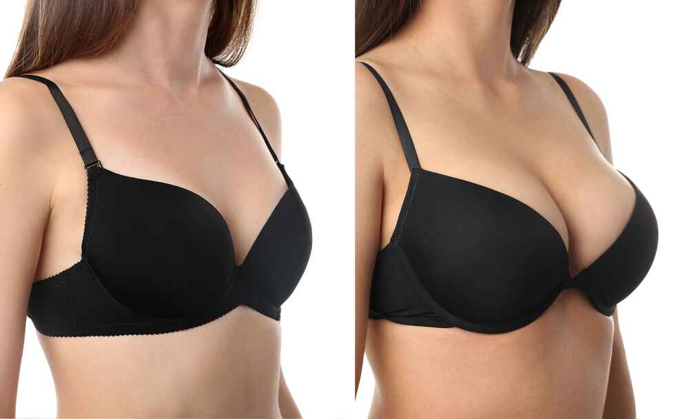 breast augmentation santa barbara