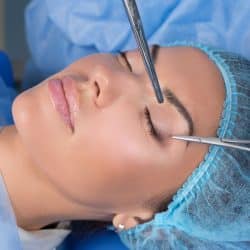 Eyelid Rejuvenation Santa Barbara