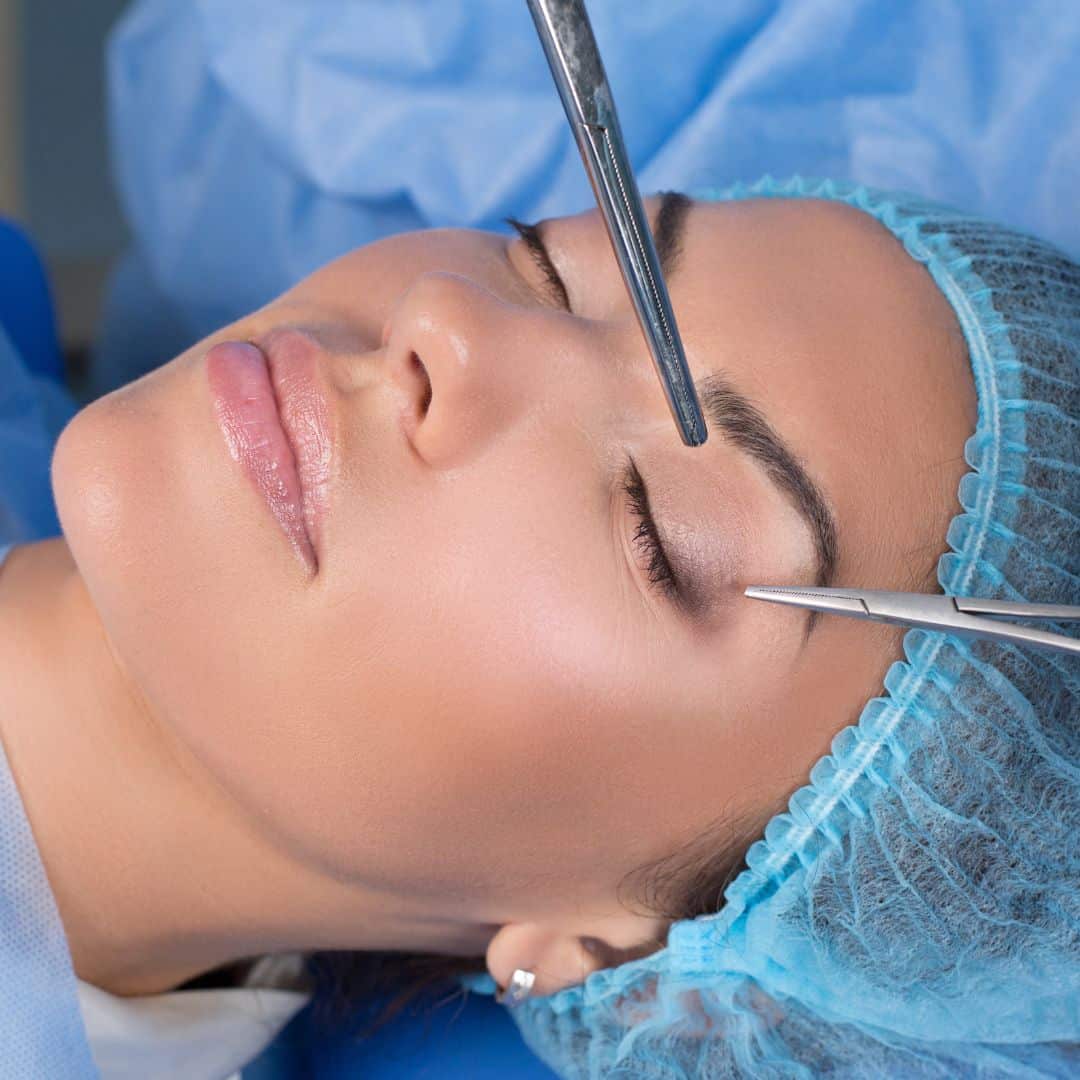 Eyelid Rejuvenation Santa Barbara