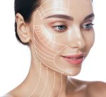 Facelift Santa Barbara