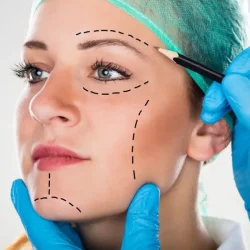 Customized facial surgery