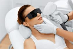 Laser Acne Scar Treatments
