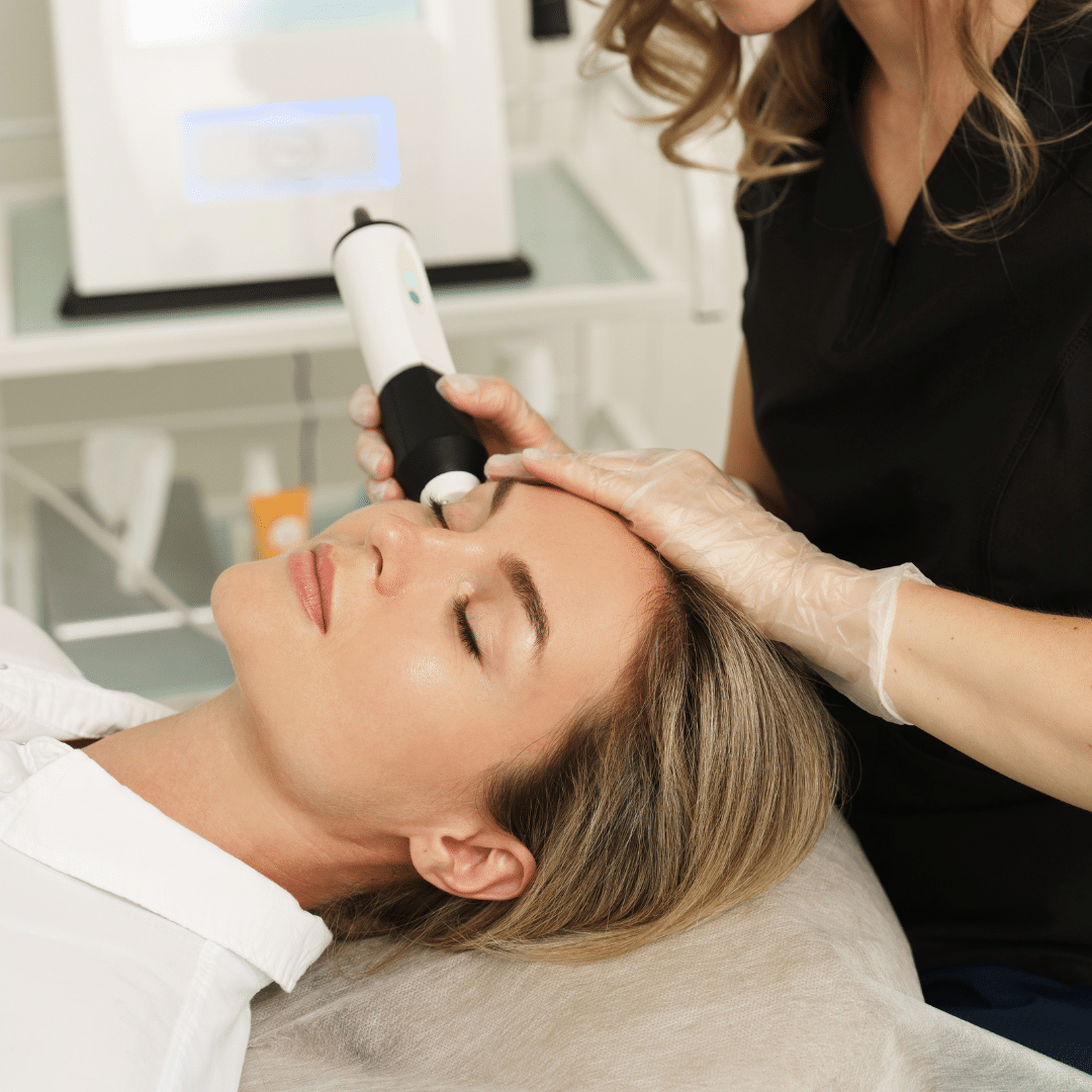 ideal laser skin resurfacing