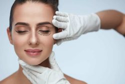 eyelid surgery in santa barbara