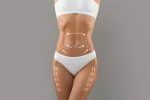 body lift los angeles
