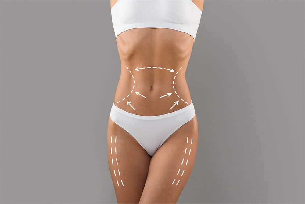 body lift los angeles
