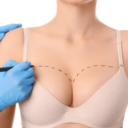 natural breast augmentation