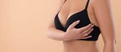 breast implant revision