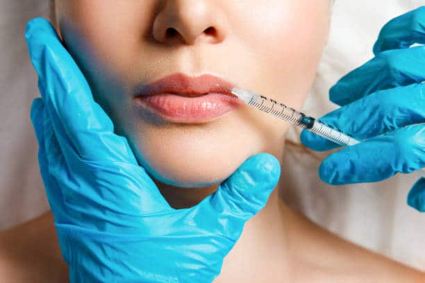 lip fillers in santa barbara