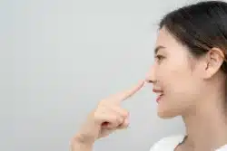 Rhinoplasty recovery guide