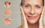 skin tightening santa barbara