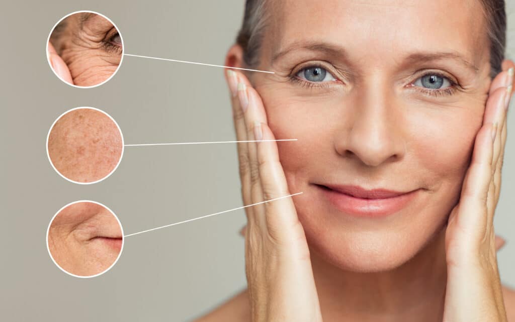 skin tightening santa barbara